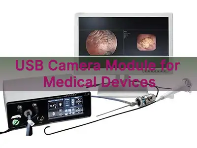 Modiwl Camera USB ar gyfer Dyfeisiau Meddygol: Canllaw Dewis Peirianneg